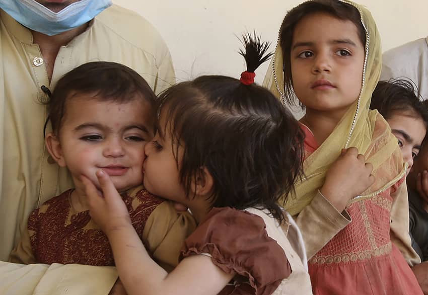 Bebé de 10 meses con poliomelitis en Pakistán